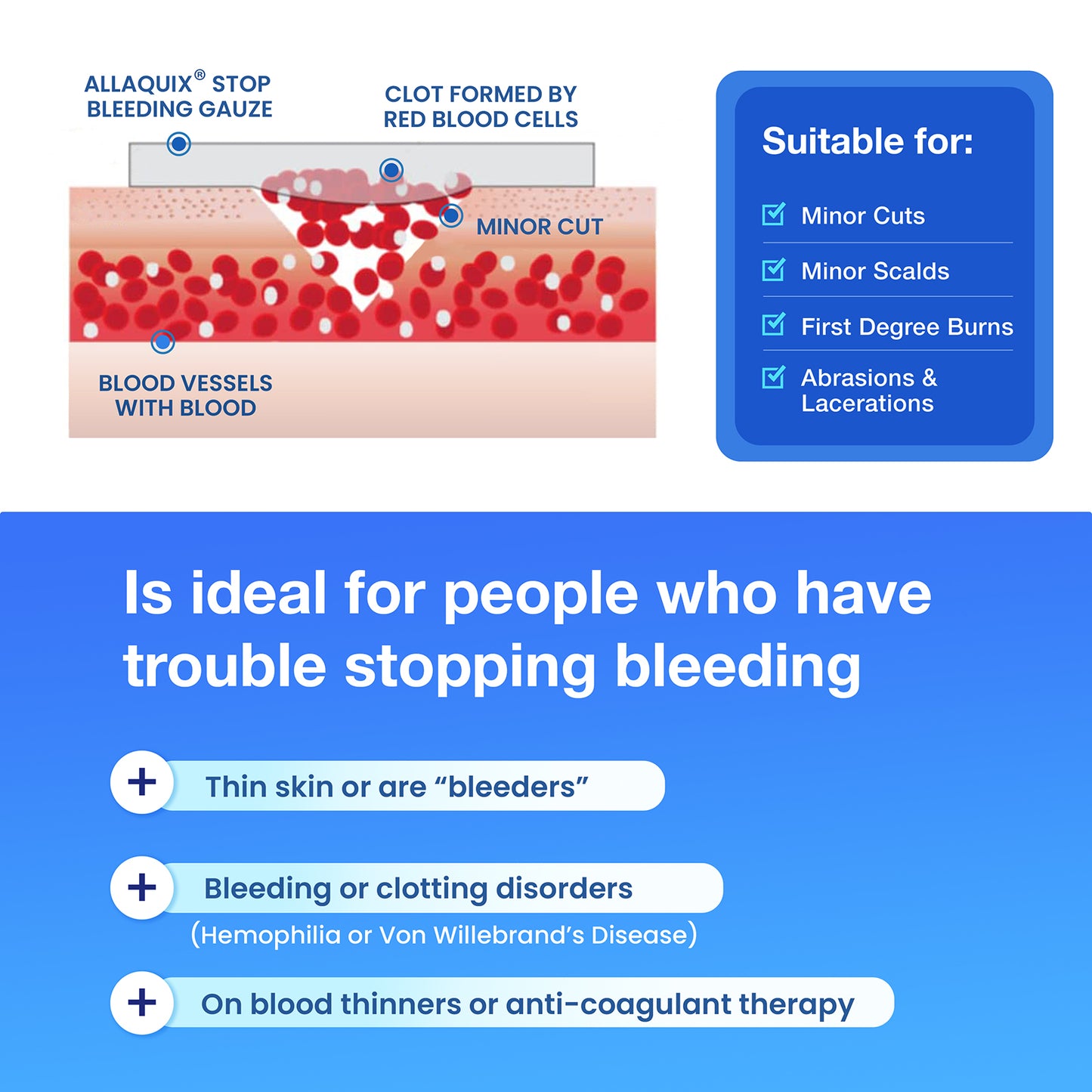 AllaQuix® High-Performance Stop Bleeding Gauze